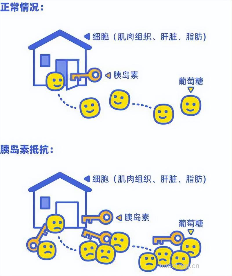 如何改善胰岛素敏感？
