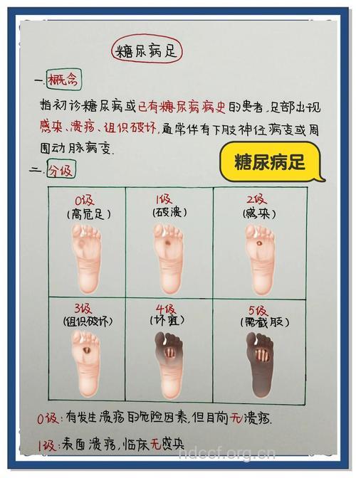 糖尿病与老寒腿的区别