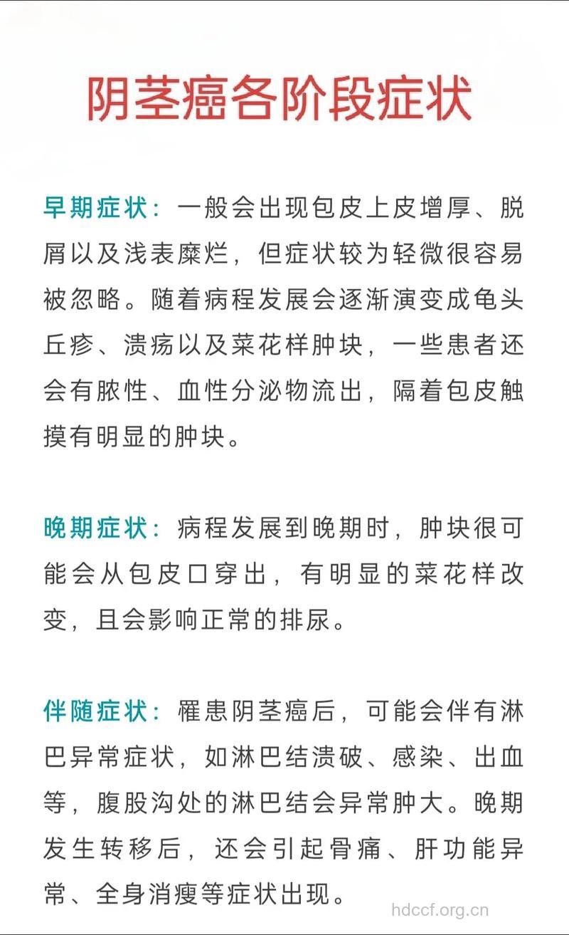 男性容易忽略的7种癌症症状