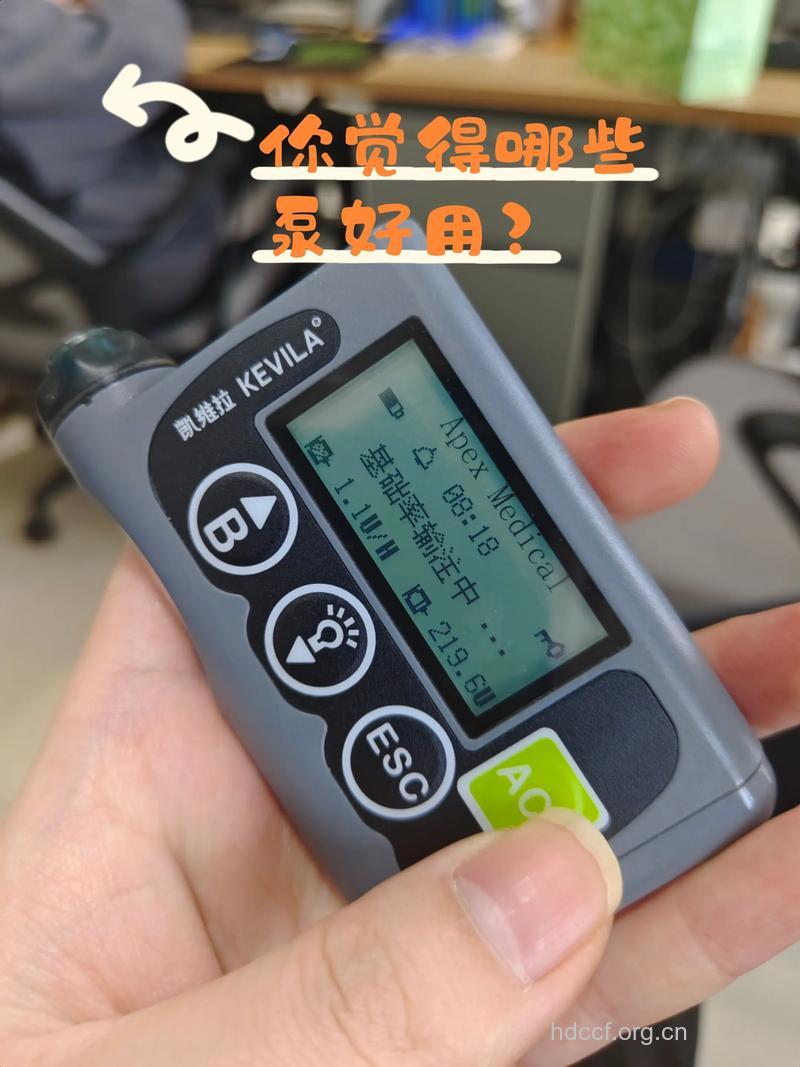 哪些糖友可戴胰岛素泵?