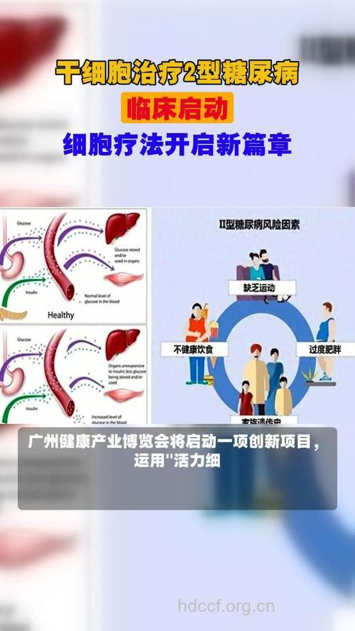 手术:2型糖尿病治疗的未来?