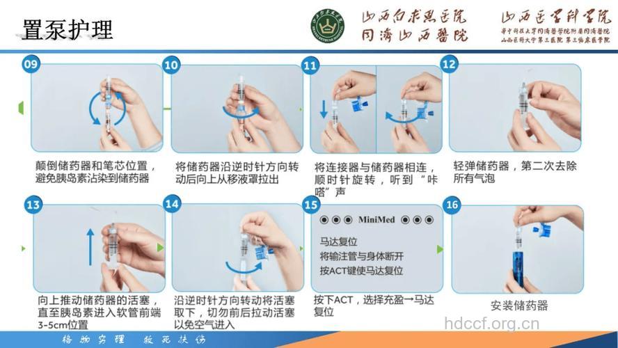 胰岛素泵治疗上学须留心