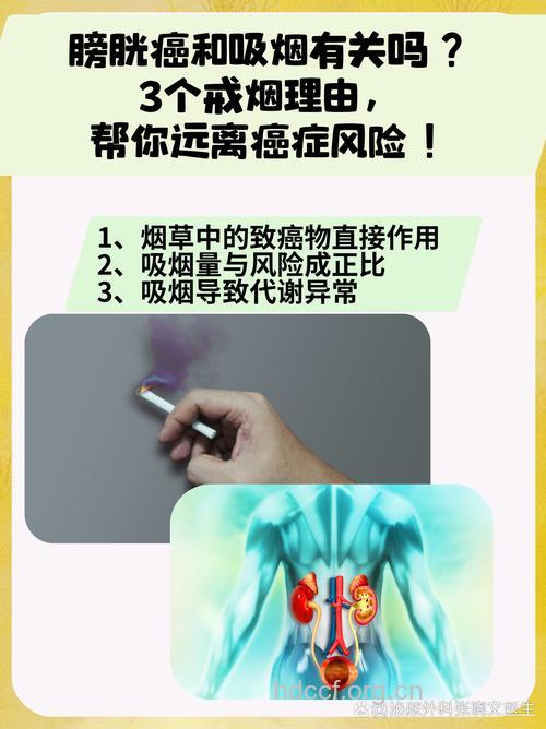 吸烟会增加罹患膀胱癌的风险
