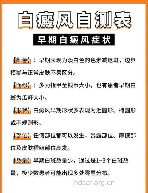 如何自查白癜风