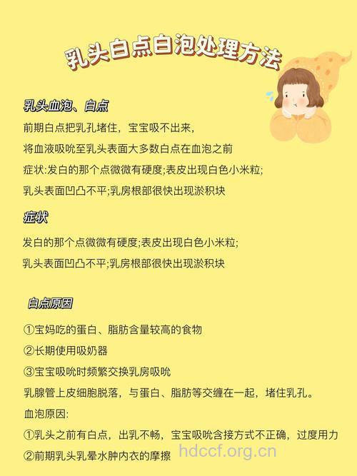 白癜风妇女可以母乳喂养吗