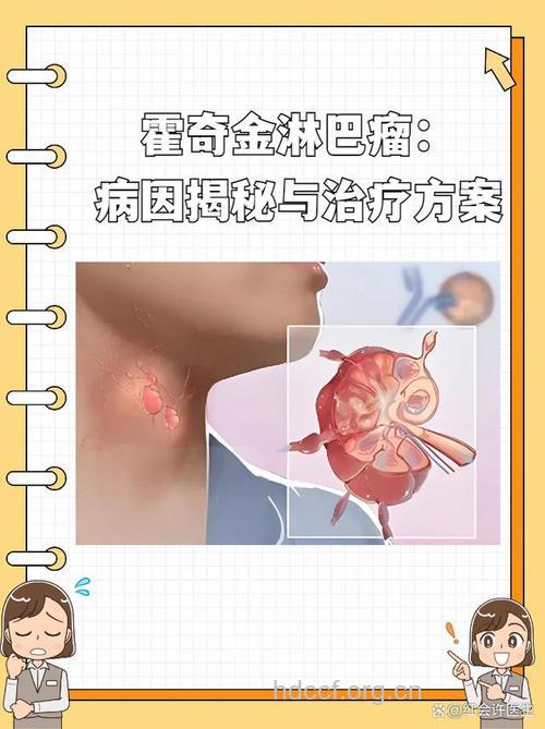 疾病百科 看看小儿霍奇金病是什么