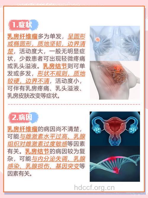 疾病百科 乳房纤维瘤的相关知识