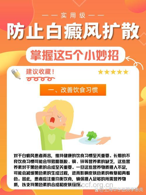 预防白癜风要“五不”