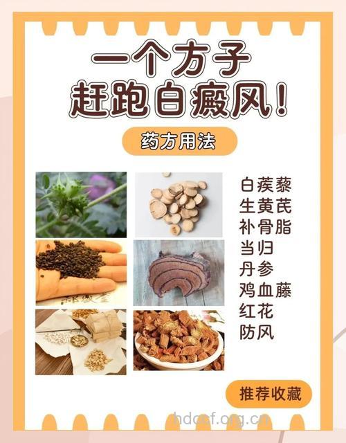 民间治疗白癜风的3个小偏方