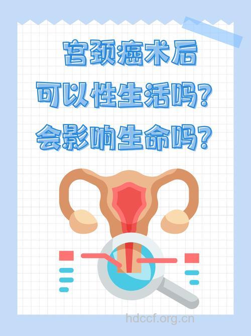 宫颈癌患者能过性生活吗