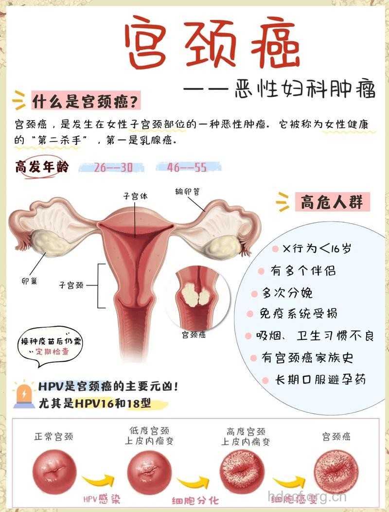 容易致癌的6大生育因素