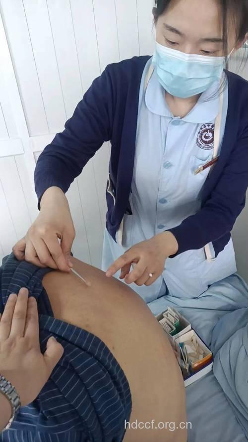糖尿病也可用针炙治疗