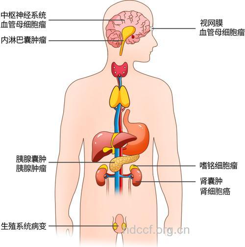 专家绘制人体癌症地图 这些器官为何容易患癌