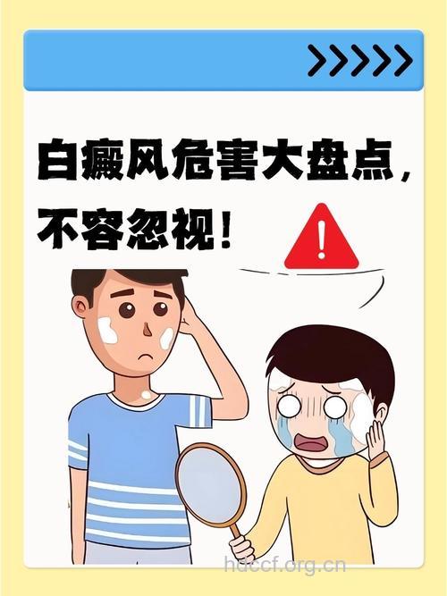 你不得不知的白癜风危害