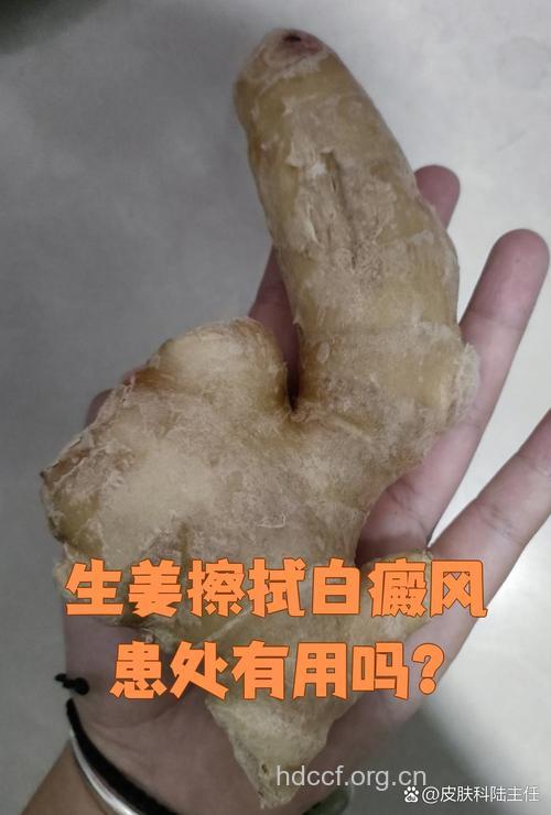 生姜片外擦巧治白癜风