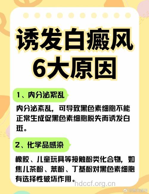 白癜风“偏爱”八大人群