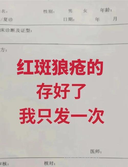 红斑狼疮的治疗方法与注意事项