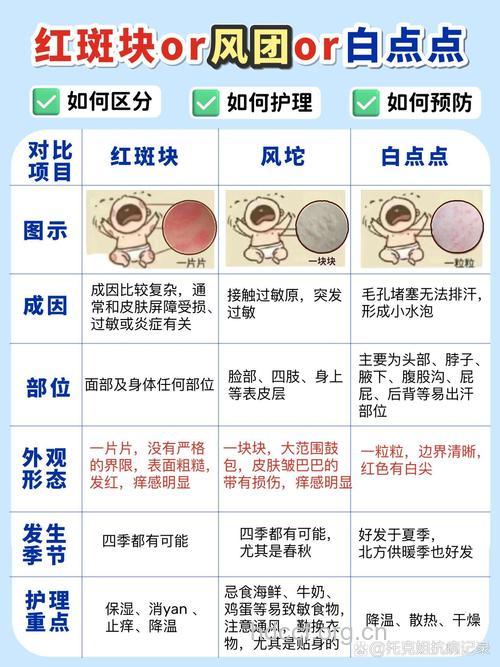 婴儿长红斑的原因及预防方法