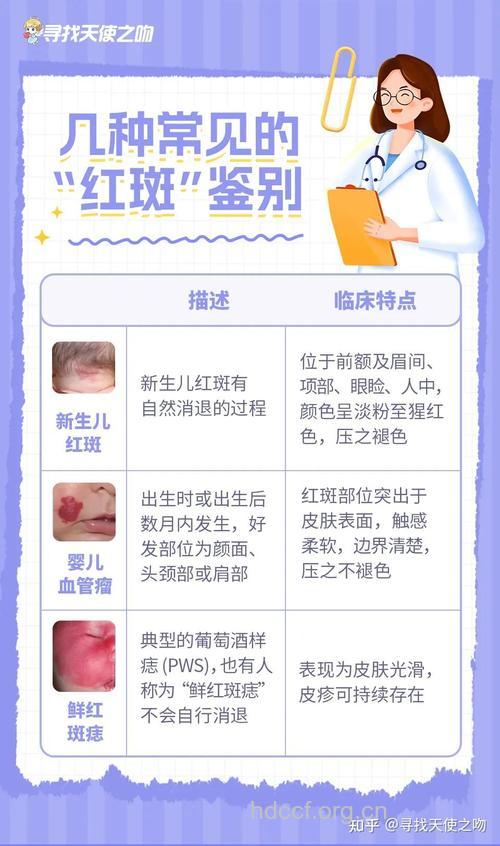 红斑容易与哪些疾病混淆