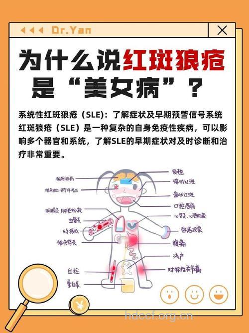 红斑狼疮常见的病因有哪些