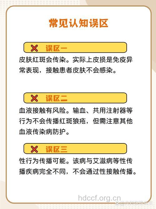 预防红斑狼疮的三种途径