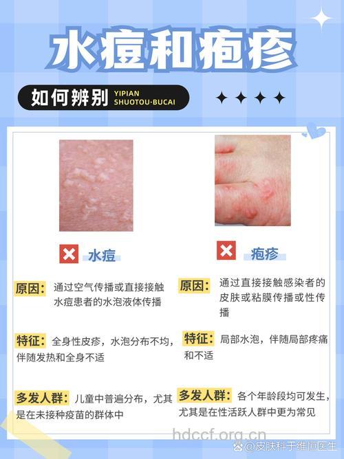 水痘难辨，该如何鉴别