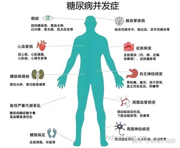 糖尿病治疗的几个阶段