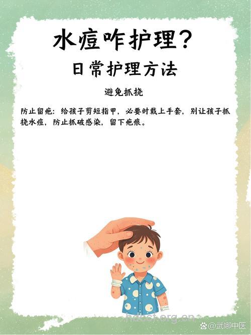 水痘护理该怎么做