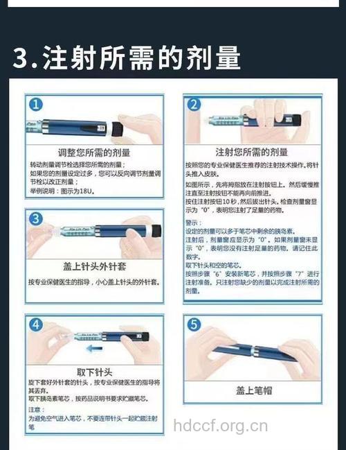 胰岛素笔治疗的四种方案