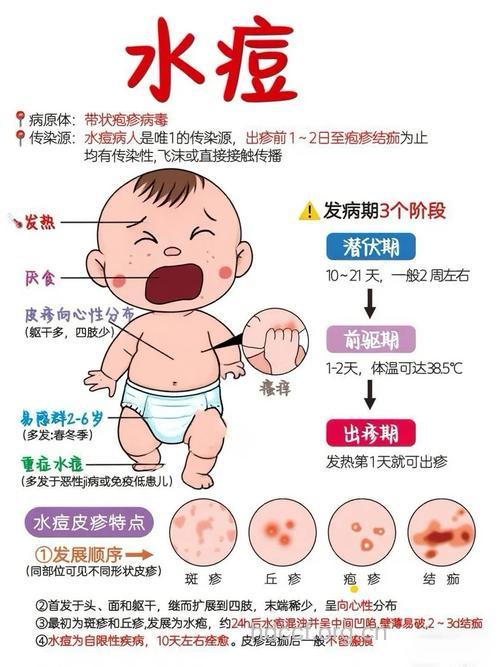 水痘的并发症不容忽视