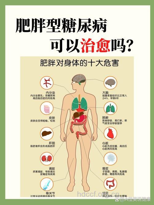 糖尿病的病因有哪些 肥胖是主因