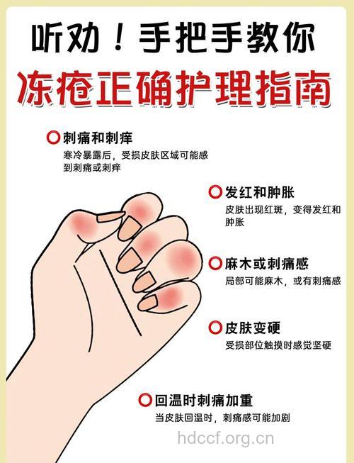 冬季要如何预防长冻疮？