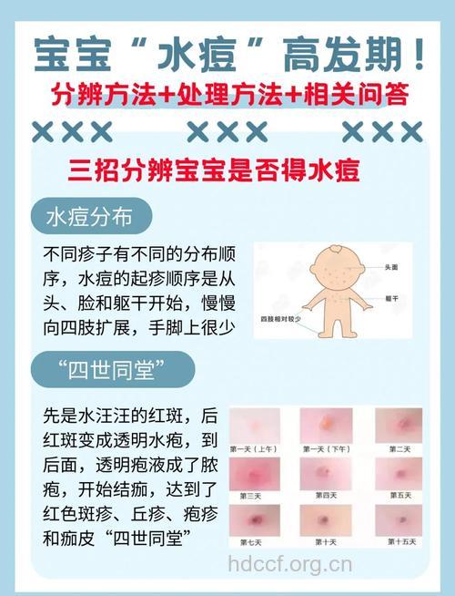 水痘的病理生理