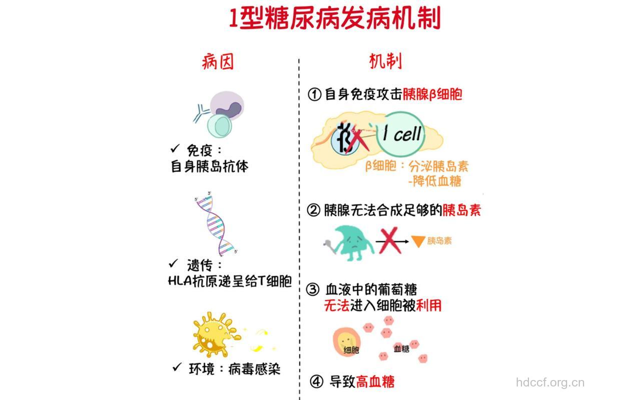 1型糖尿病的病因主要有哪些