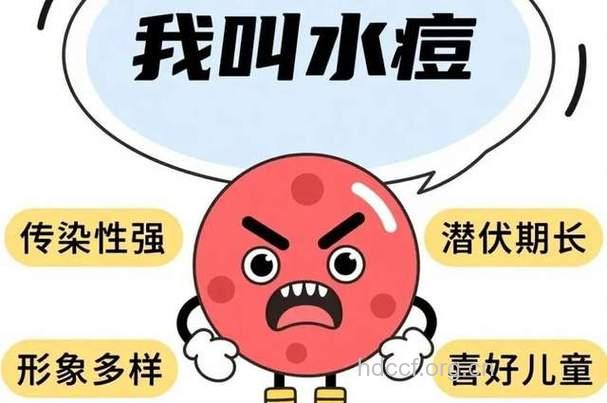 患水痘千万不要揉眼睛