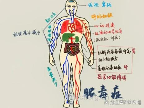 糖尿病患者下肢循环变差该如何发现