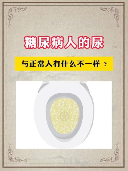 糖尿病必须注意的四次尿检