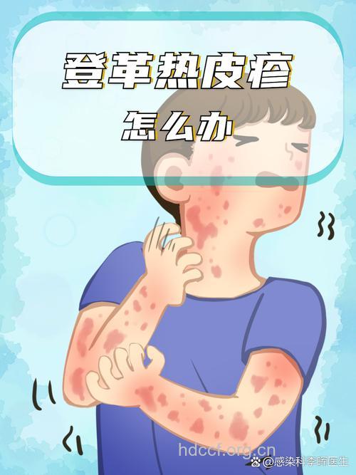 你是怎么惹上传染病的？