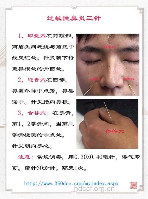 中医针灸可消除红鼻子