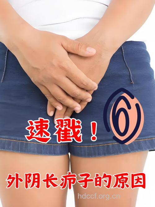 妇科病 女性下半身最大的敌人