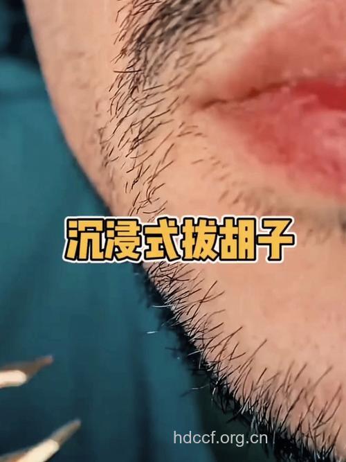 男人拔了胡须 小心没命了