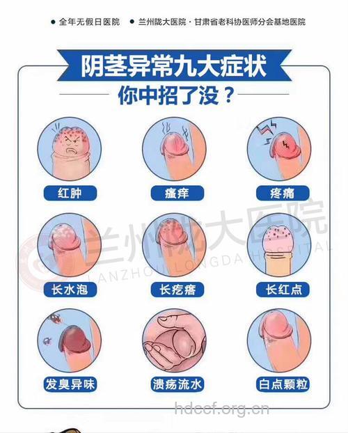 男性容易患上的6种疾病