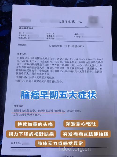 脑膜瘤的临床症状有哪些