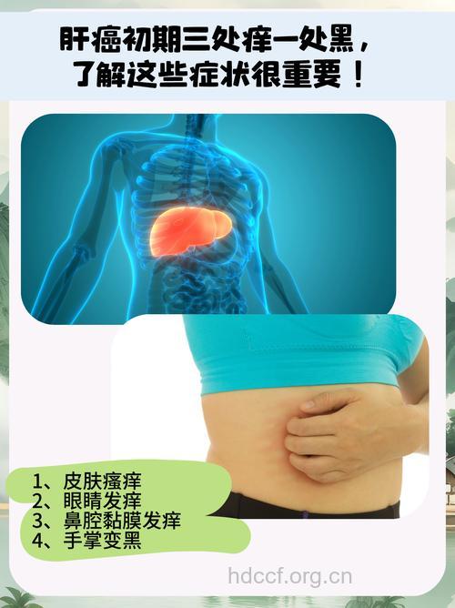 身体瘙痒小心癌症作怪