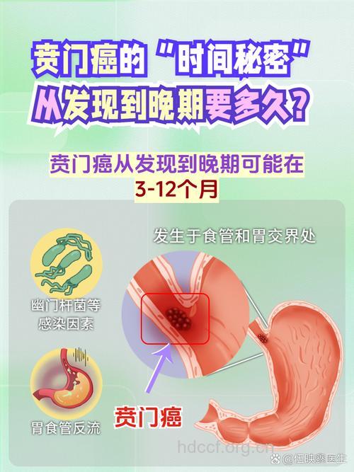贲门癌是如何发生的呢