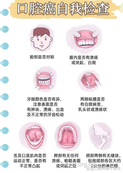 哪些不良习惯会导致口腔癌