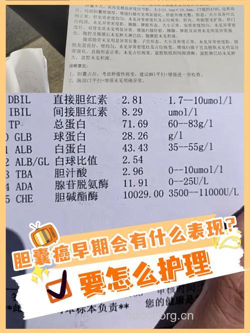 胆囊癌早期检查要注意什么
