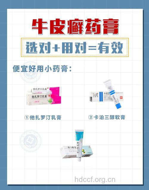 牛皮癣患者的用药选择