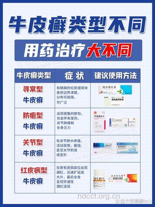 不同银屑病治法各不相同