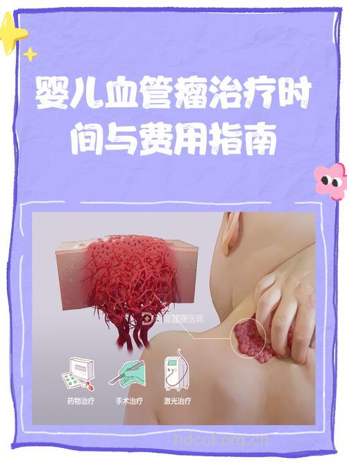 什么时候是治疗婴儿血管瘤的最佳时机